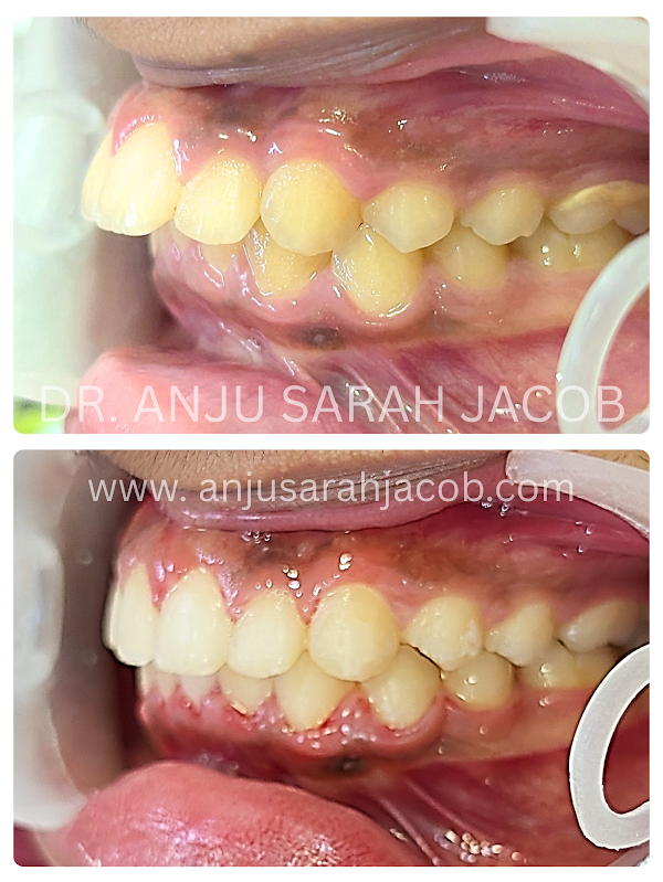 Case 17, view 3 of 9