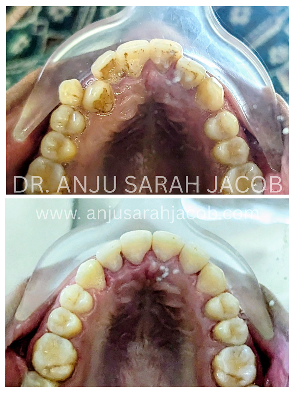 Case 15, view 4 of 9