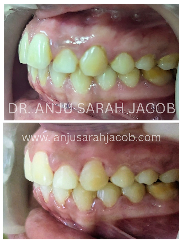 Case 15, view 3 of 9